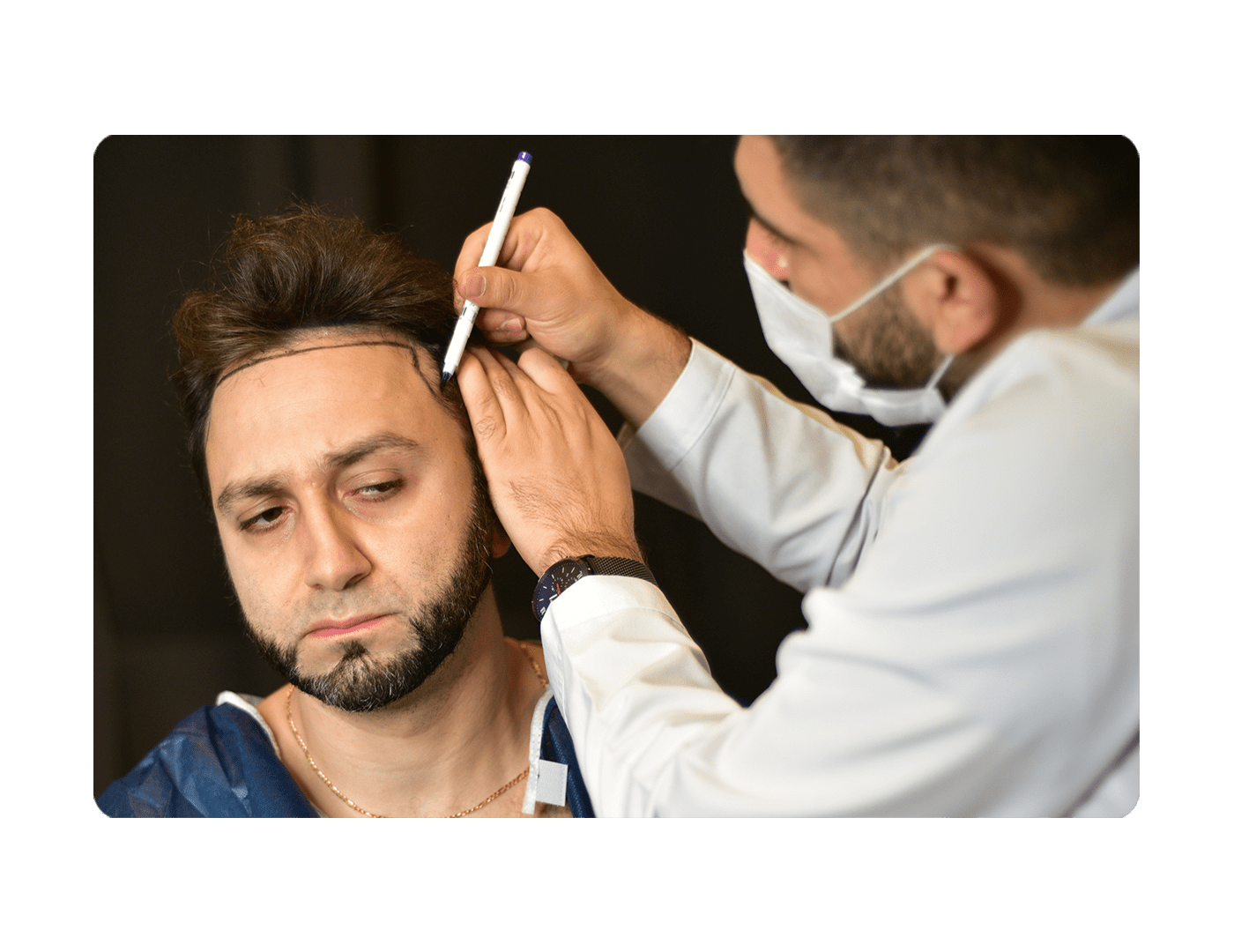 hair-transplant-istanbul-long-hair-center-long-hair-center